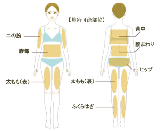 施術可能部位